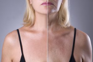 Laser Treatments | Medaestheticsva.com