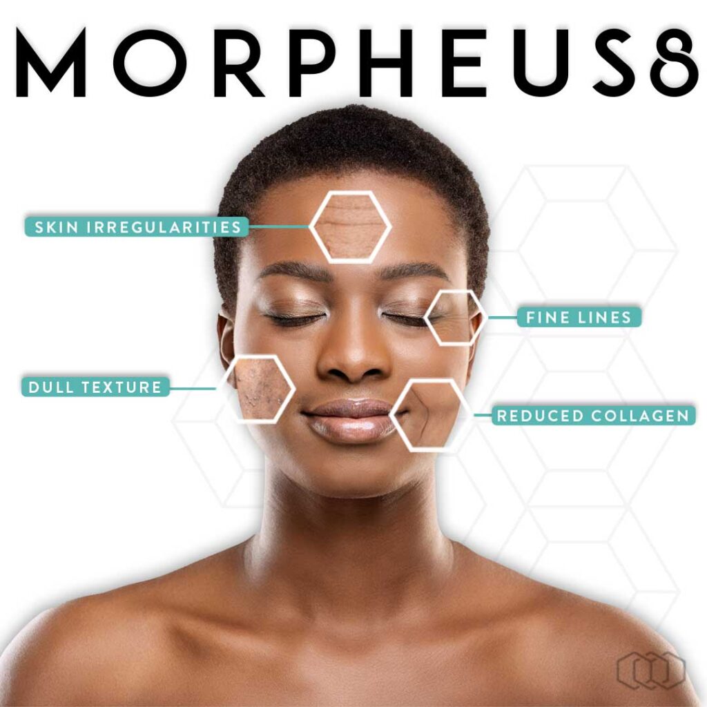 Morpheus8 Infographic